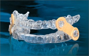 oral appliance, night guard to prevent teeth grinding.